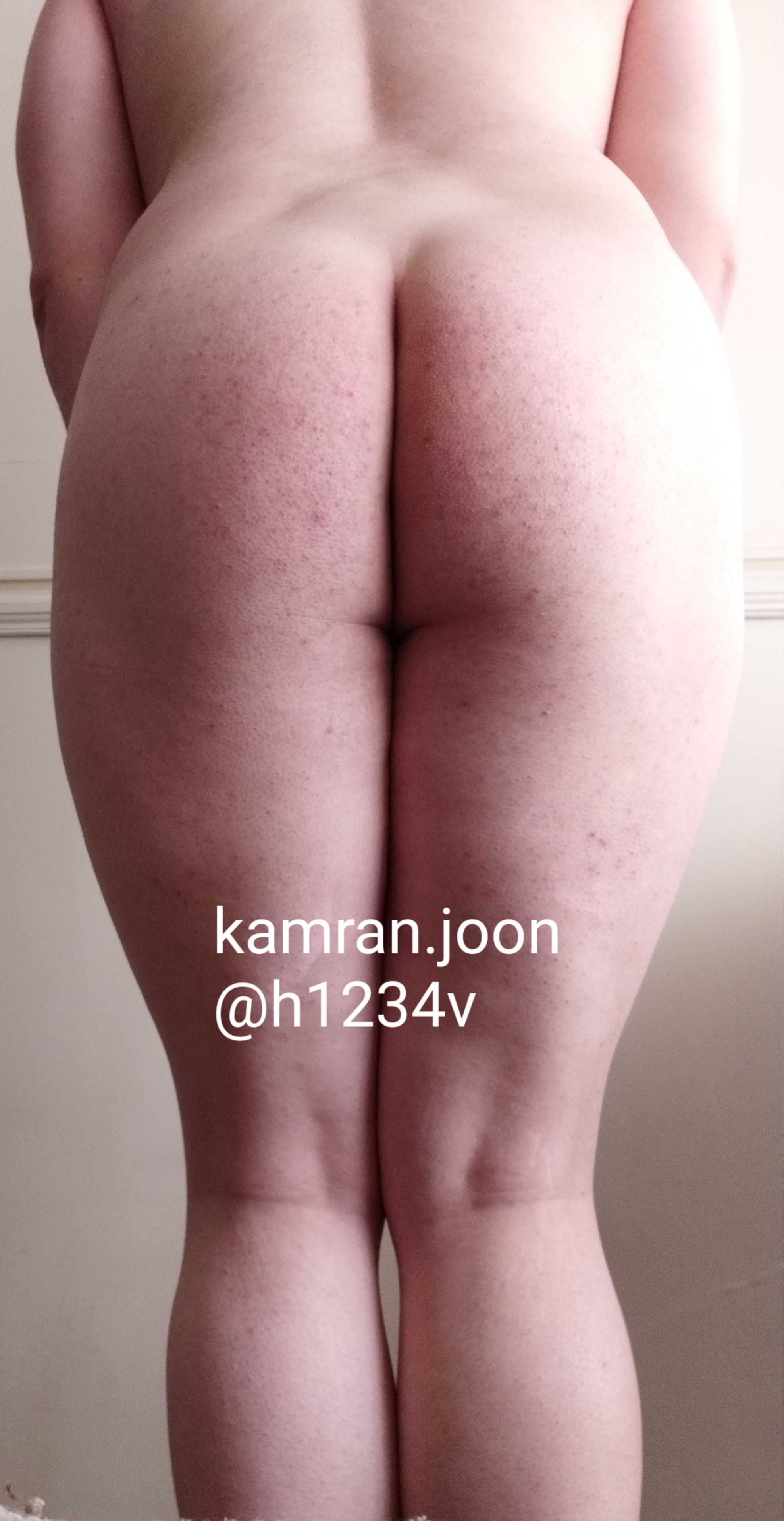Post 218 asset 1