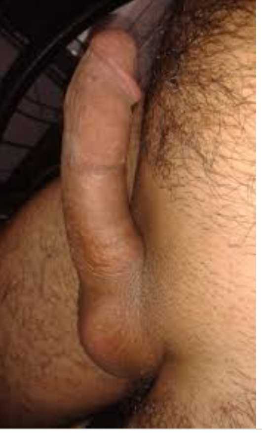 Post 2279 asset 1