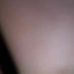 rxccg