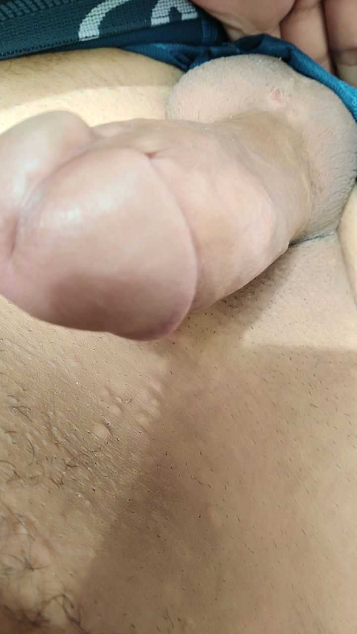 Post 551 asset 1