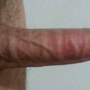 Post 5401