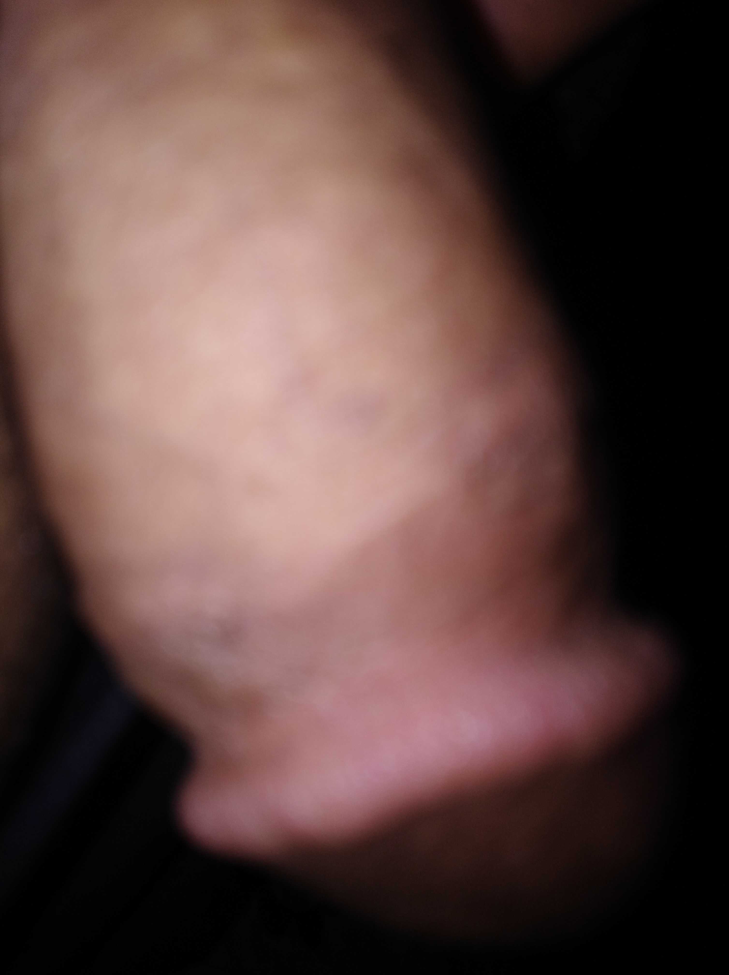 Post 7135 asset 1