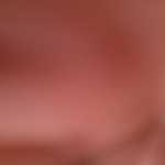 Rrer