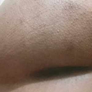 Post 32434