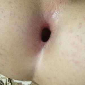 Post 32767