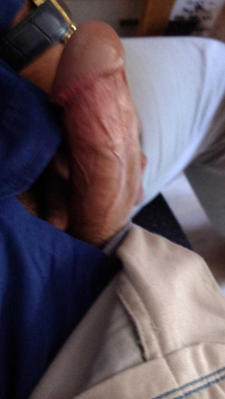 #[1173] سن بالا <br>@َArman_fzll <br>ایدی تل