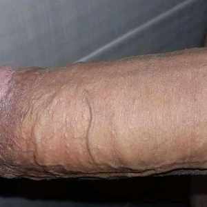 Post 50172