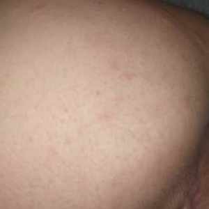 😍😋👍سوراخی که دیشب توسط بنده مورد حمله قرار گرفت