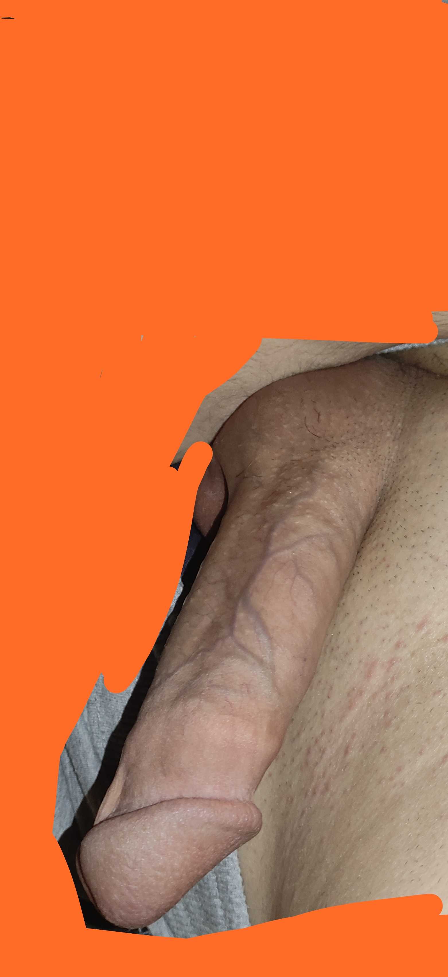 Post 59755 asset 1