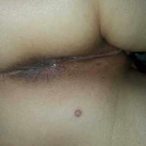 Post 63401