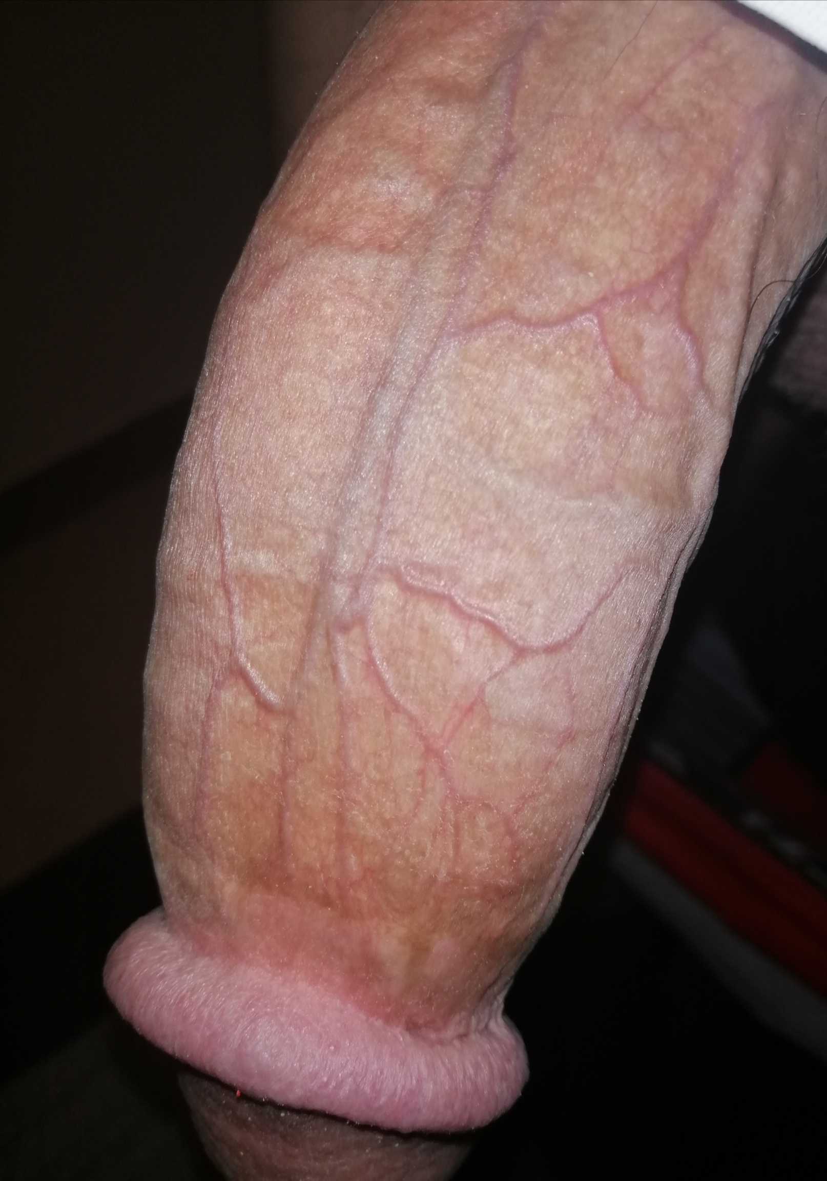 رگاش