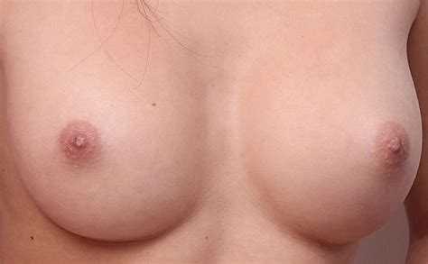 Post 76529 asset 7