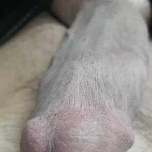 Post 95104