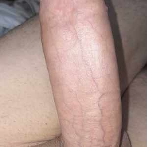 Post 103200