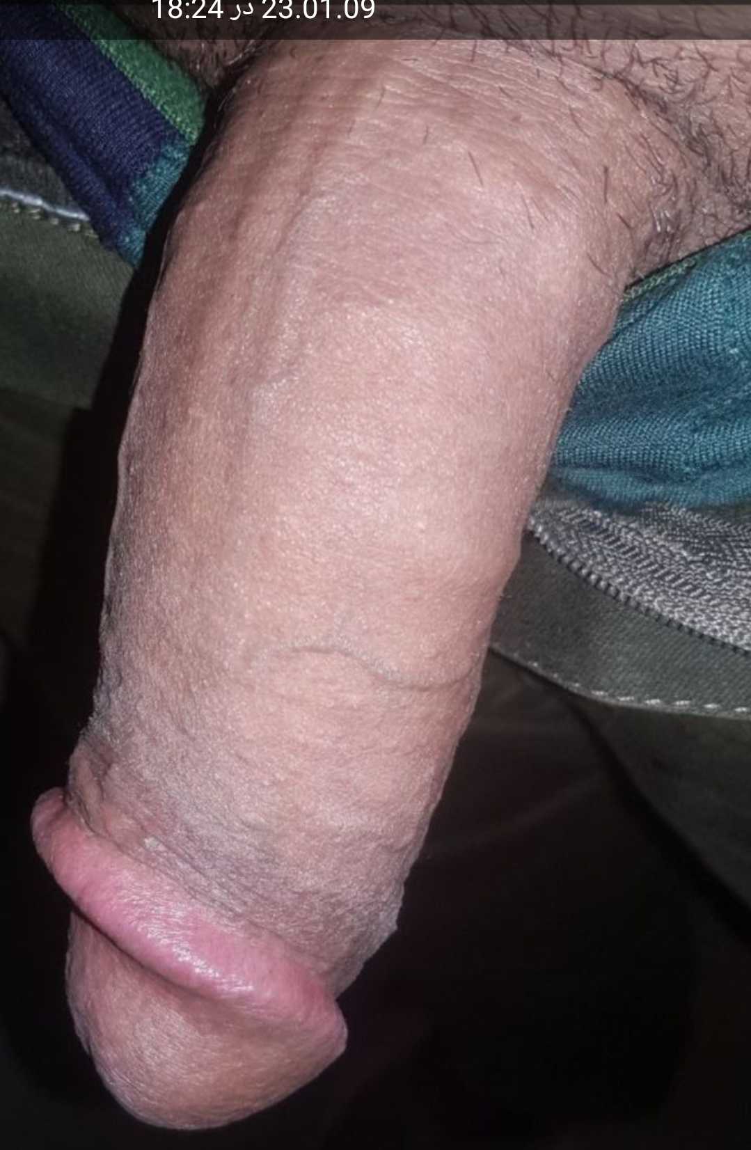 Post 105170 asset 1