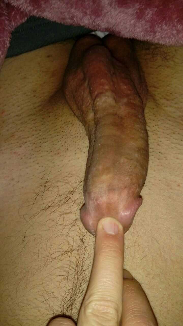 tlg:@Mfmgru