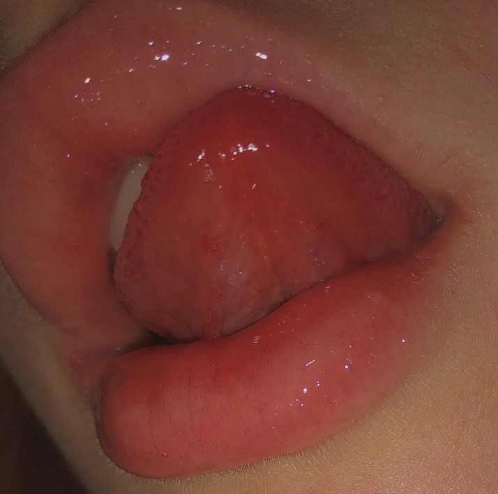 elisa_hub